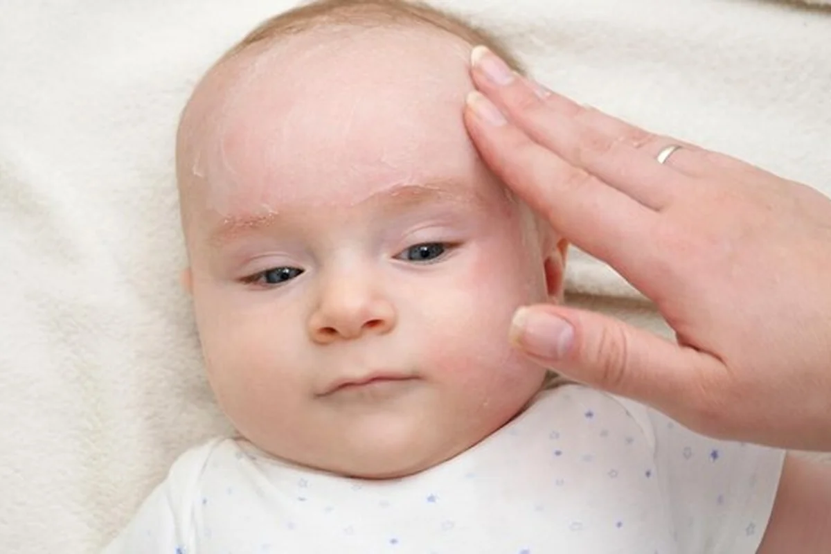 Matka nakłada krem na twarz niemowlaka